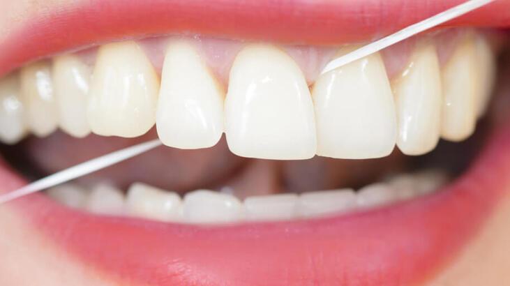 Diş Eti Hastalıkları Tedavisi (Periodontoloji)