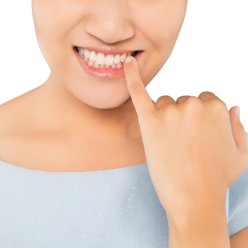 Формирование десен