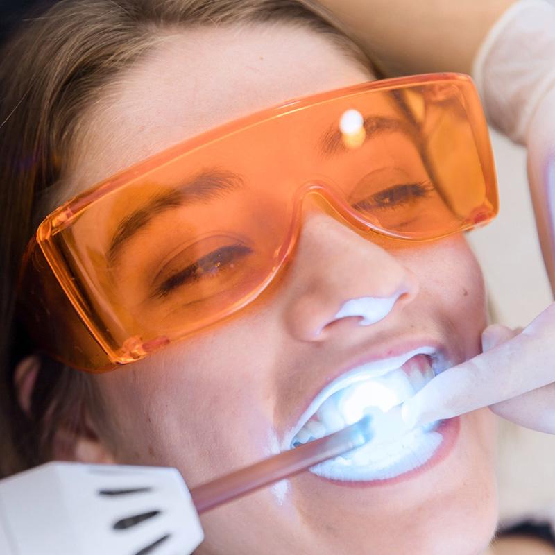Отбеливание зубов