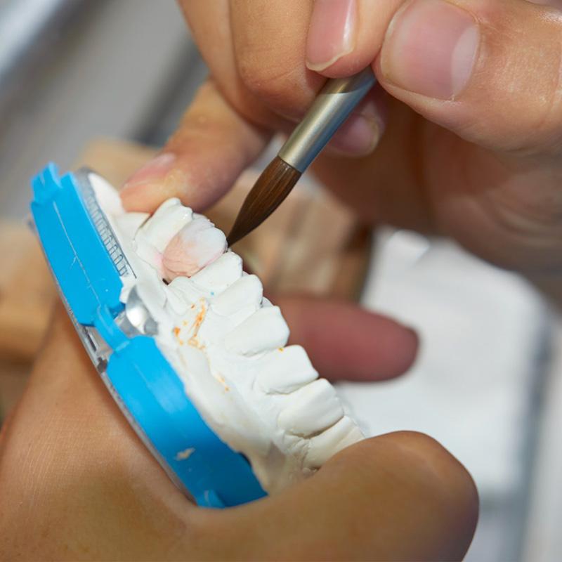 Художественная реставрация зубов